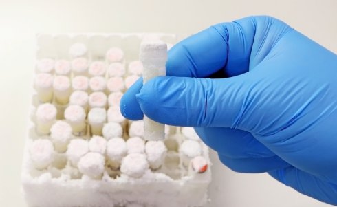 Should the Future of Frozen Embryos Be Addressed in a Prenuptial Agreement?